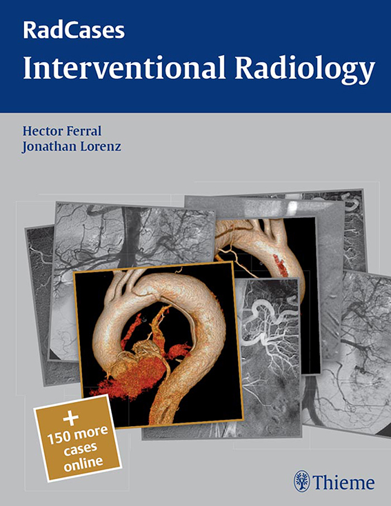 [RadCases] Ferral - Interventional Radiology
